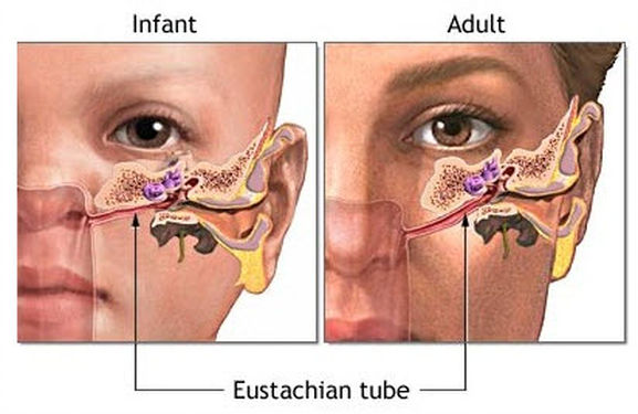 Ears, Antibiotics and Asthma…Yet Another Perfect Storm